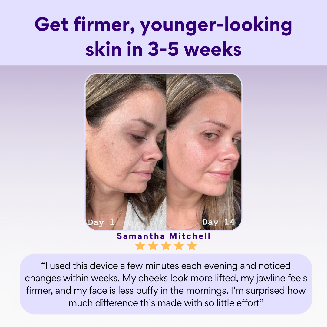 SculptPulse Skin Lifting