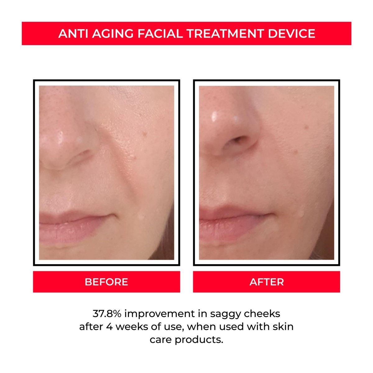 ANTI AGING SKIN-R BOOSTER PRO